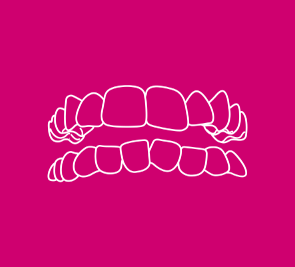 Dentes apinhados